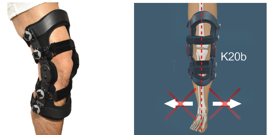 Hinged Brace Details